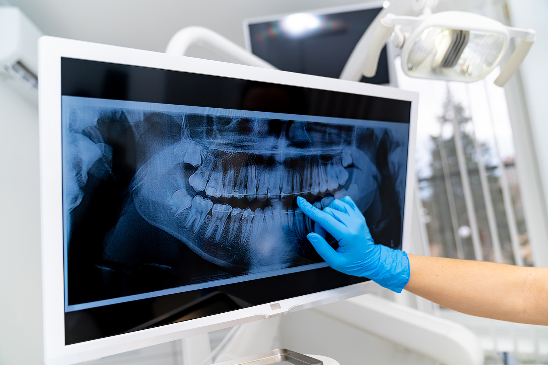 Falls Dental Care Group | Sports Mouthguards, Teeth Whitening and Veneers