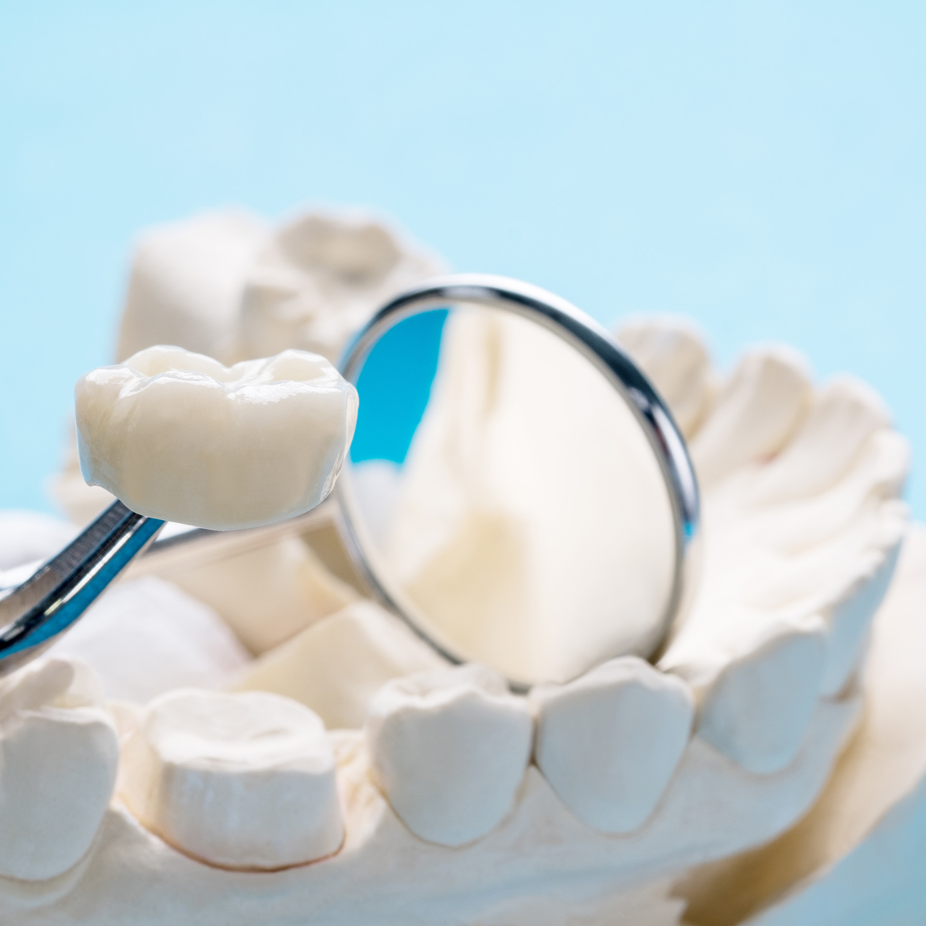 Falls Dental Care Group | Extractions, Invisalign reg  and Veneers