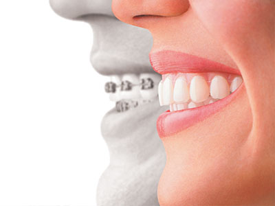 Falls Dental Care Group | Teeth Whitening, Periodontal Treatment and Crowns Caps