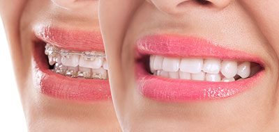 Falls Dental Care Group | Sedation Dentistry, Sleep Apnea and Vizilitem reg