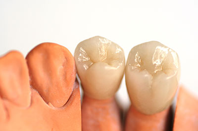 Falls Dental Care Group | Sports Mouthguards, Emergency Treatment and Digital Radiography