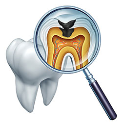 Falls Dental Care Group | Dental Fillings, Night Guards and Vizilitem reg