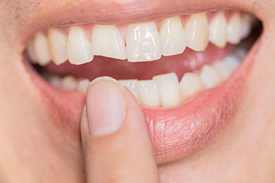 Falls Dental Care Group | Initial Oral Exam, Snoring Appliances and Dental Fillings