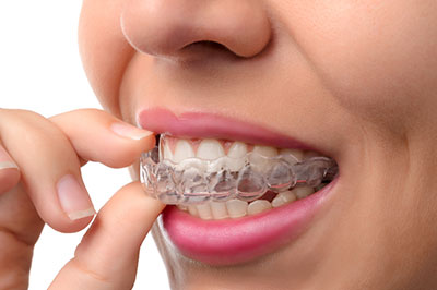 Falls Dental Care Group | Sleep Apnea, Sports Mouthguards and Implant Dentistry