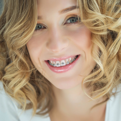 Falls Dental Care Group | Veneers, Crowns   Caps and Bridges
