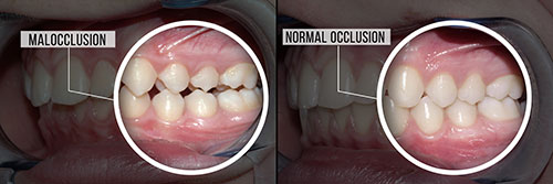 Falls Dental Care Group | Sleep Apnea, Bridges and Emergency Treatment