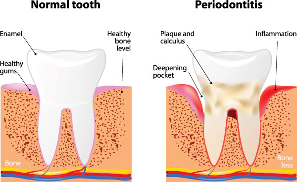 Falls Dental Care Group | Periodontal Treatment, Bridges and All-on-4 reg  Implants