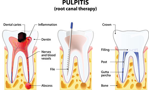 Falls Dental Care Group | Dentures, Snoring Appliances and Implant Dentistry