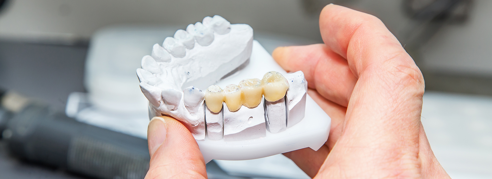 Falls Dental Care Group | Snoring Appliances, Periodontal Treatment and Root Canals