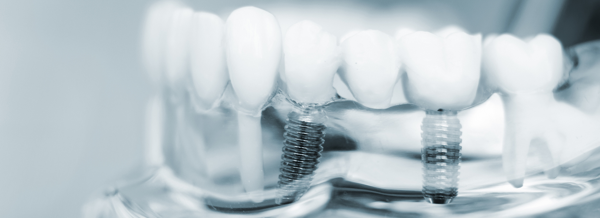 Falls Dental Care Group | Sedation Dentistry, Crowns Caps and Invisalign reg