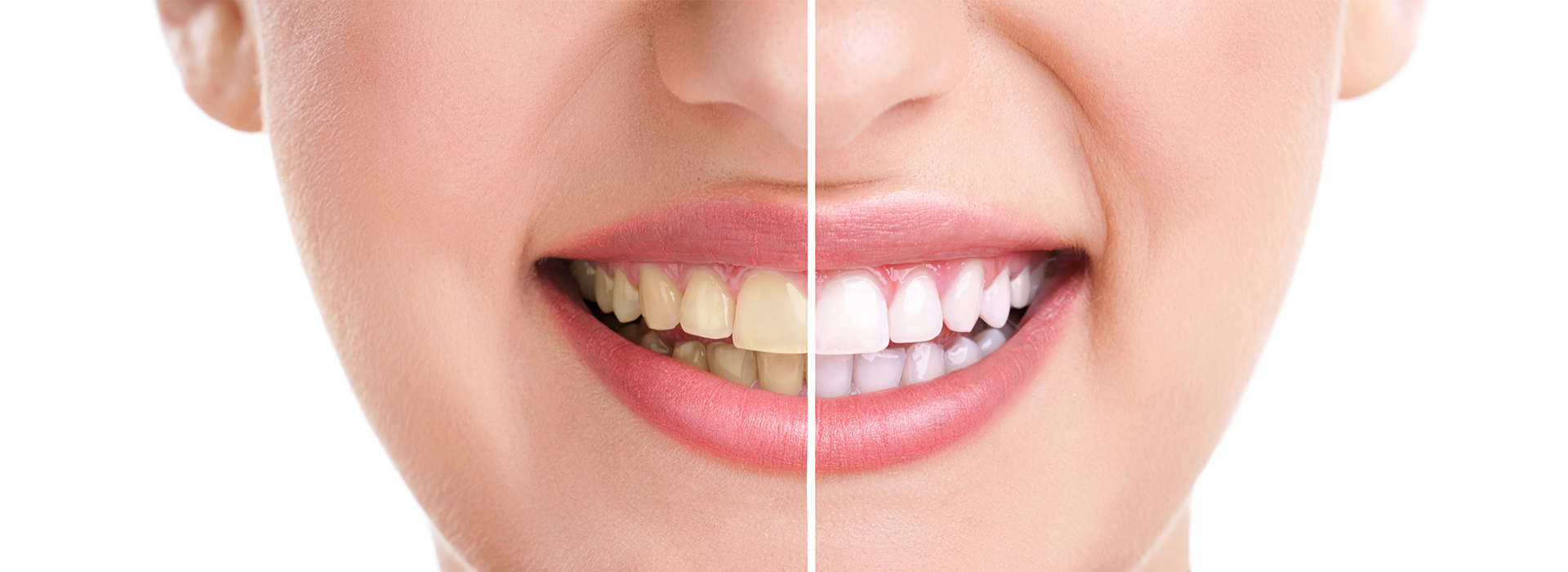 Falls Dental Care Group | All-on-4 reg Implants, Digital Radiography and Extractions