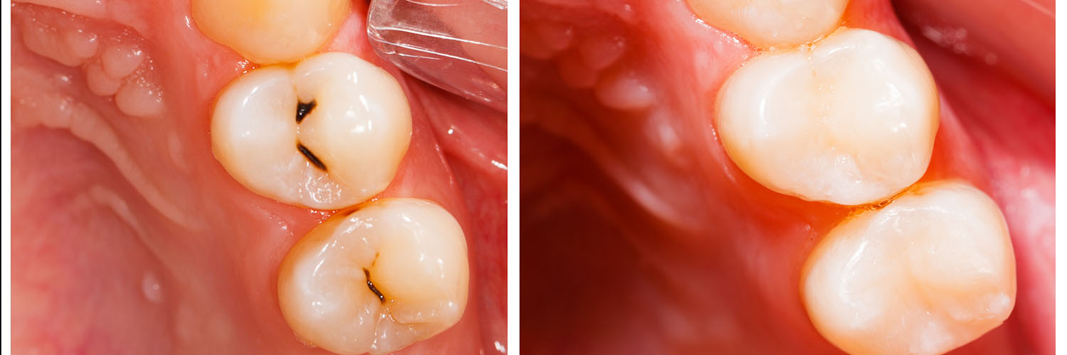 Falls Dental Care Group