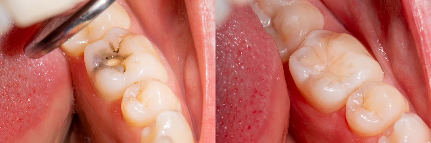 Falls Dental Care Group
