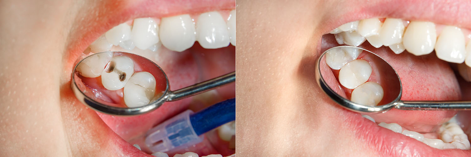 Falls Dental Care Group