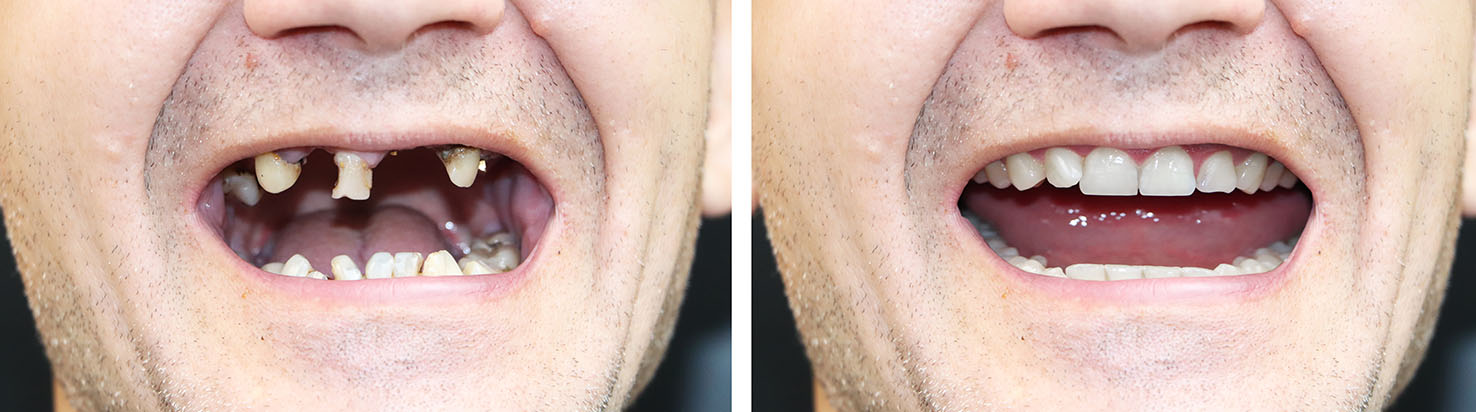 Falls Dental Care Group