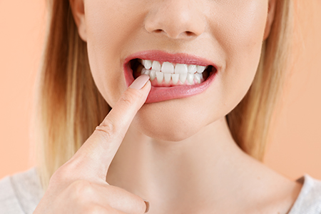 Falls Dental Care Group